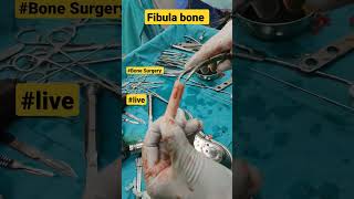 Fibula Bone Graft | #fibula #fibulafracture #bonegraft #bonegrafting #bonesurgery #bonefracture #acl screenshot 3