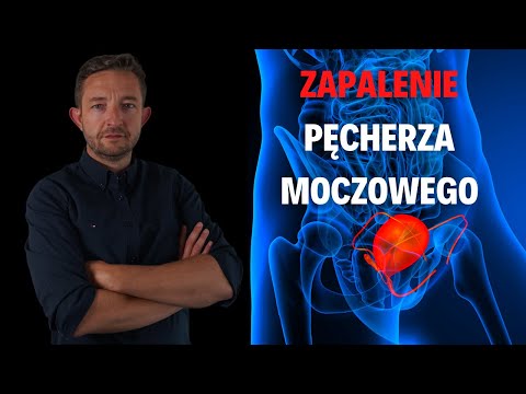 Wideo: Jak radzić sobie z infekcją pęcherza: 13 kroków (ze zdjęciami)