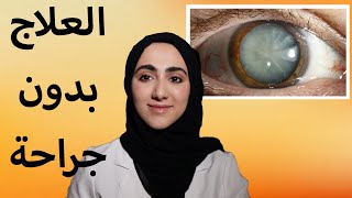 علاج الماء الابيض في العين بدون جراحة | د ايمان الحمادي