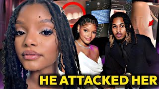 Halle Bailey Accuses Ddg Of Dv She Got A Restraining Order And Full Custody