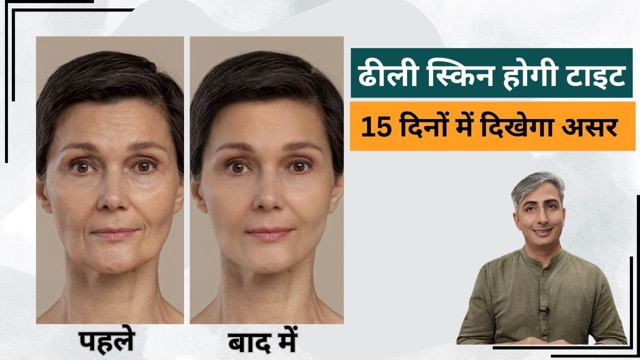 कितनी भी ढीली स्किन 15 दिनों में होगी टाइट I SKIN TIGHTNING HOME REMEDIES I DR  MANOJ DAS
