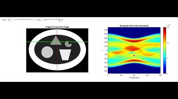MATLAB: X-ray transform (CT scanner data)