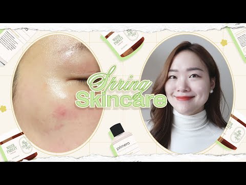 My <strong>Best</strong> Skincare Tips for <strong>Spring</strong> / Transitional Period! Dealing with redness, itchiness, whiteheads