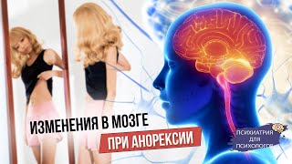 Нарушения в мозге при нервной анорексии