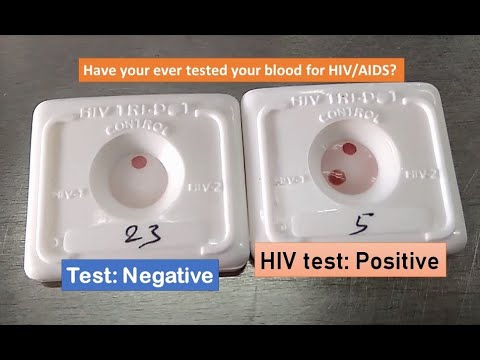 Video: Europæiske Mitokondriske Haplogrupper Forudsiger Leverrelaterede Resultater Hos Patienter, Der Er Inficeret Med HIV Og HCV: En Retrospektiv Undersøgelse