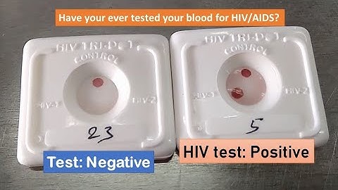 Know your HIV status within half an hour ||HIV test positive|| HIV TRI DOT