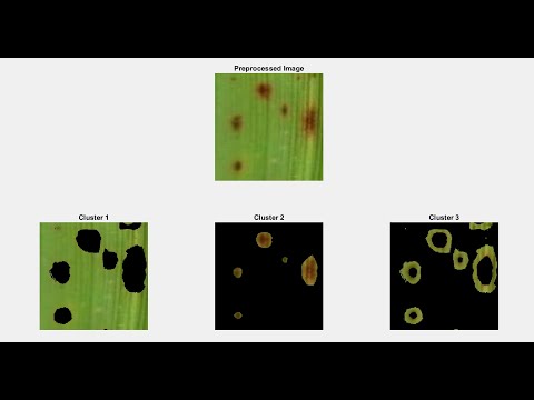 #finalyearprojects 2021 | Random Forest Classification For Paddy Plant Disease