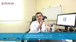 العلاج الجراحي لألم أسفل العمود الفقري الجزء الثالث surgical management of low back pain  Dr osama