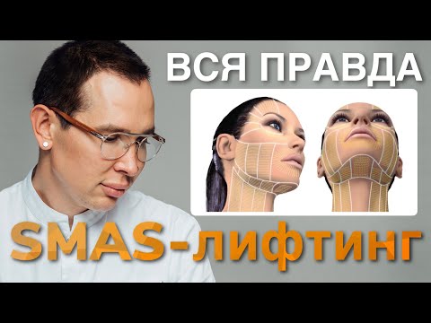 SMAS лифтинг ВСЯ ПРАВДА #smasлифтинг