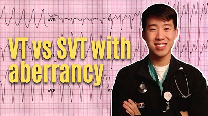 VT vs. SVT With Aberrancy Explained - High Yield & Made Easy!