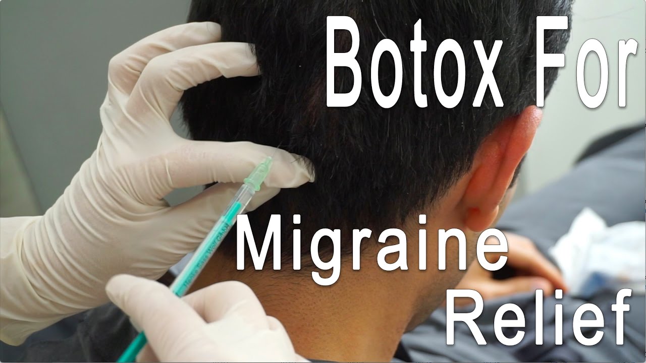 Migraine Relief With Botox | BLUSH Beverly Hills - YouTube Migraine Relief With Botox | BLUSH Beverly Hills - YouTube