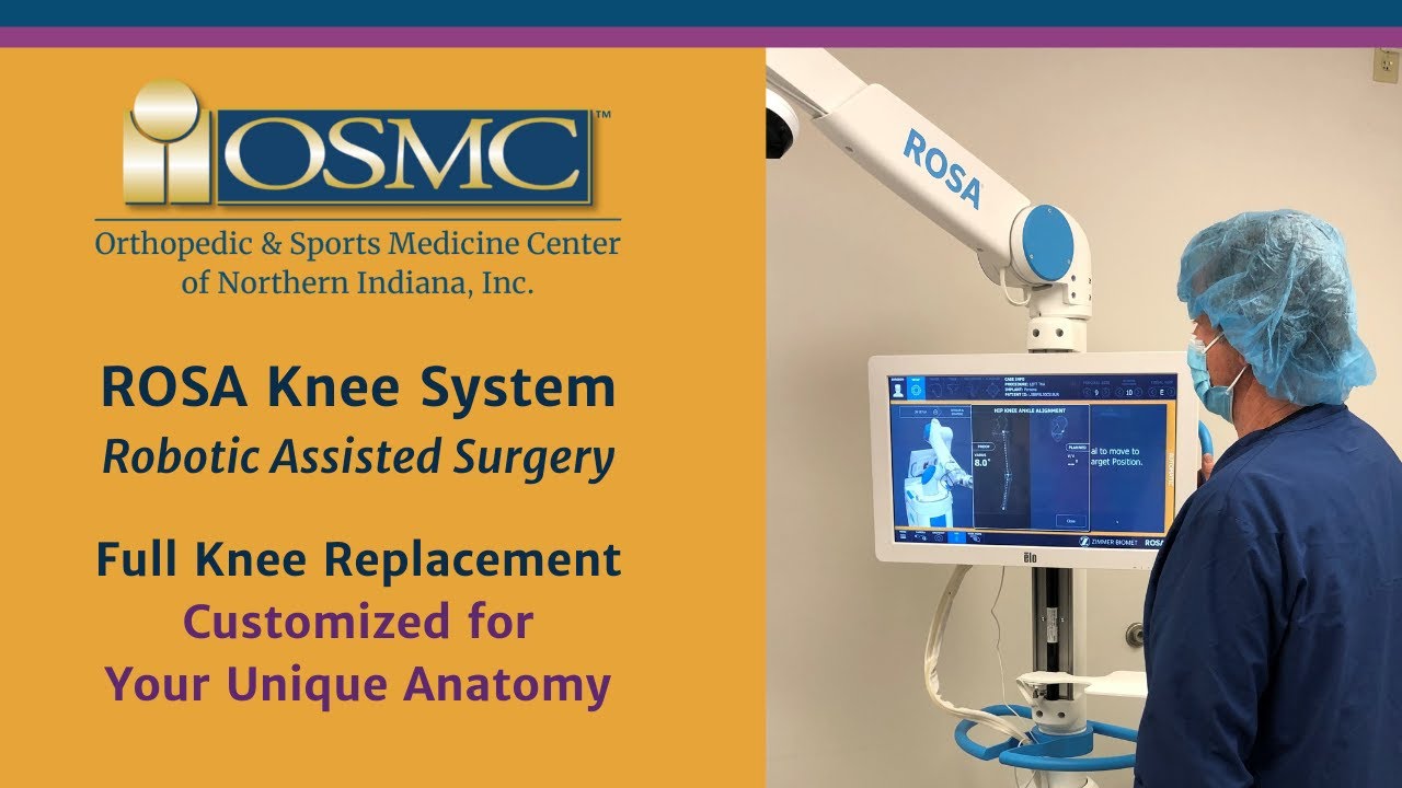 ROSA Knee Replacement Information Patient Video by Zimmer Biomet YouTube