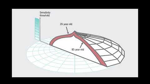 8 - Visual field interpretation (Artifacts in the visual field)