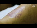The Oldest Tattooing Family in the World