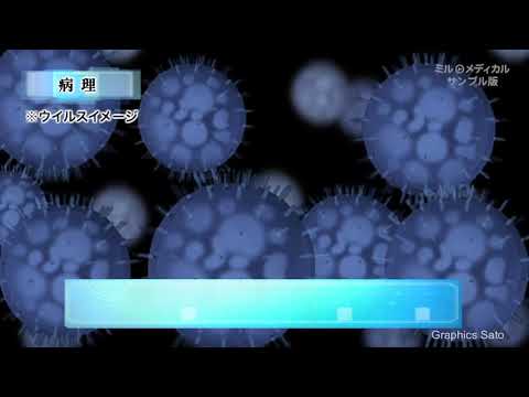 外陰がん／ミルメディカル　家庭の医学 動画版