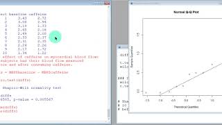 Ch. 8.5 - Part 5:  Wilcoxon-Signed-Rank Test in R