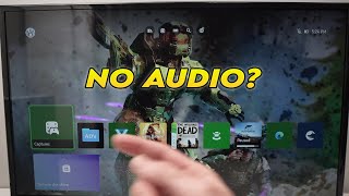 Xbox Series X/S: How to Fix if You Have No Sound