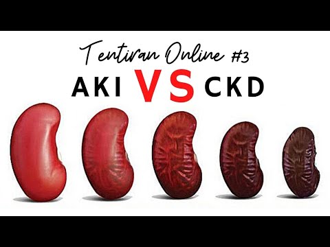 Video: Perbezaan Antara Kecederaan Ginjal Akut (AKI) Dan Penyakit Ginjal Kronik (CKD)