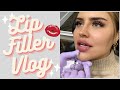 LIP FILLER VLOG| 1ml Restylane Kysse, Q&A ♡