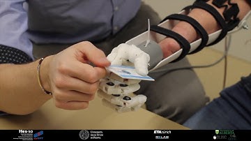 Multifunction control and evaluation of a 3D printed hand prosthesis