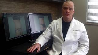 Advances with Liposuction in St Louis, Missouri.