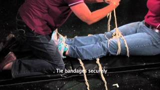 Anatomic Splint