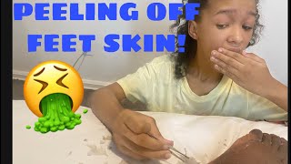 ASMR SKIN FEET PULLING  PART 1 #fun #asmr #feet #skin #part1 #new #wow #crazy #ew #nasty