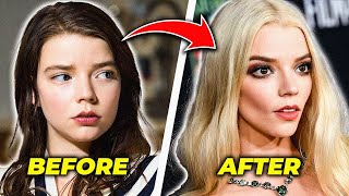 The DARK Truth Behind Anya Taylor Joy’s Face Transformation!