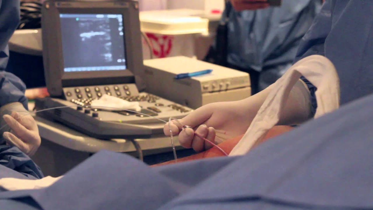 Várices. Nuevos métodos de tratamiento endovascular