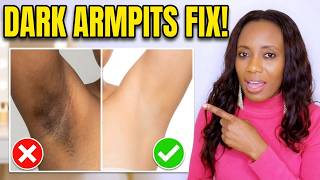 Why Your Armpits  Underarms Look This Way, Black Underarms  Hyperpigmentation  Lighten Armpits