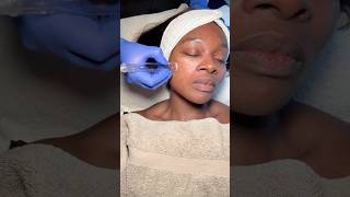 Bridal Beauty Prep You Need Before the Big Day #bridalskincare #weddingpreparation