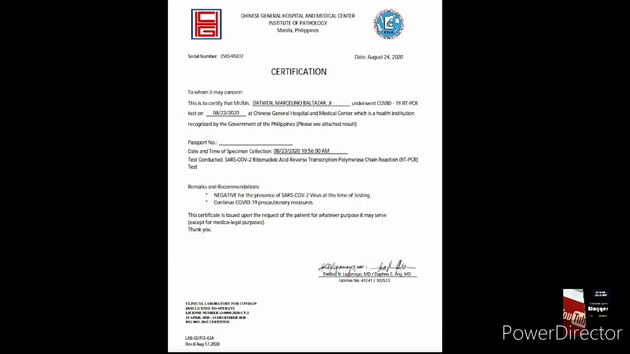 Swab Test Result Is Negative