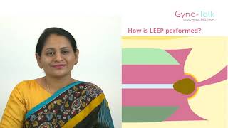 LEEP - What | How | Risks | Dr, Safeena Anas | Gynecology & Obstetrics