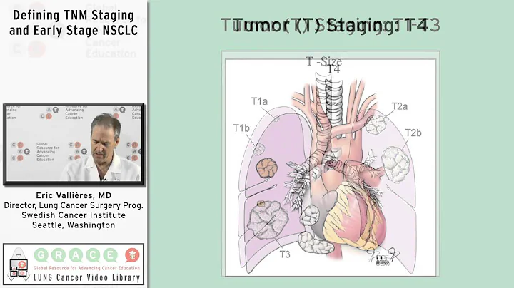 Defining TNM Staging and Early Stage NSCLC