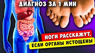 Это повторяется Всегда! Так старые Врачи по НОГАМ определяют многие Болезни...