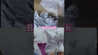 Ultrasound show baby Boy Baby kick in mothe womb mbbs1styear B.sc nursing viral neet2024 ???❤️?
