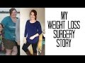 How & Why I lost over 100 lbs with VSG Weight Loss Surgery