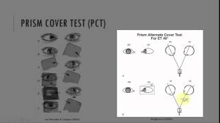 Prism Cover Test (PCT)