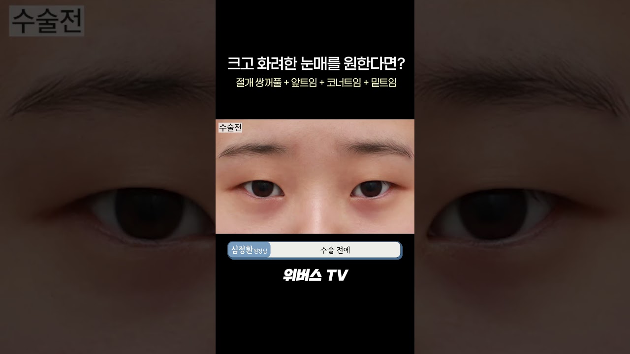 [Вивэрс гоо сайхны мэс заслын эмнэлэг] Томоо, гоёмсог нүдийг хүсэж байна уу? Тэгвэл заавал үзээрэй‼️