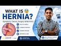 What is a Hernia? 😨 Symptoms, Causes, Surgery &amp; Recovery Explained | Dr. Kundan Kharde
