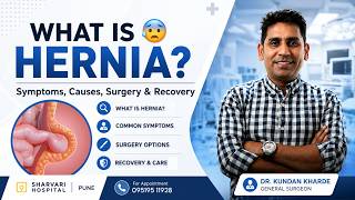 What is a Hernia? 😨 Symptoms, Causes, Surgery & Recovery Explained | Dr. Kundan Kharde
