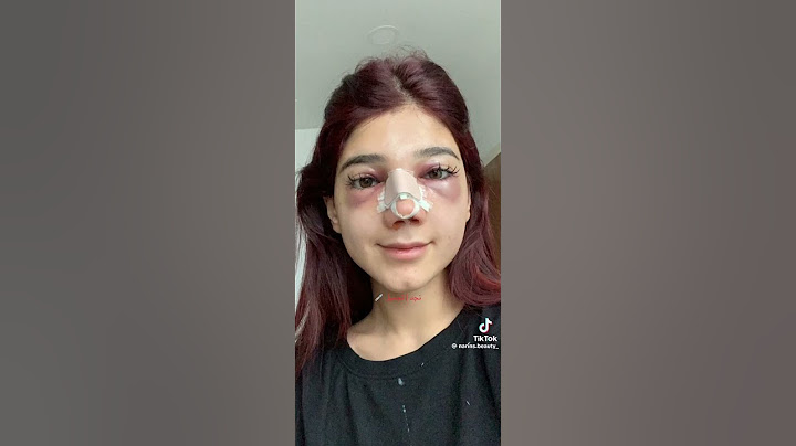 نارين قبل التجميل وبعد😗 #نارين_بيوتي