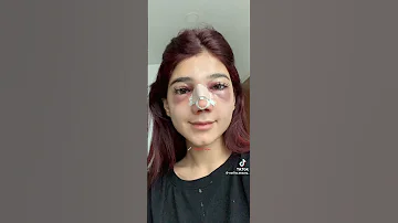 نارين قبل التجميل وبعد نارين بيوتي 
