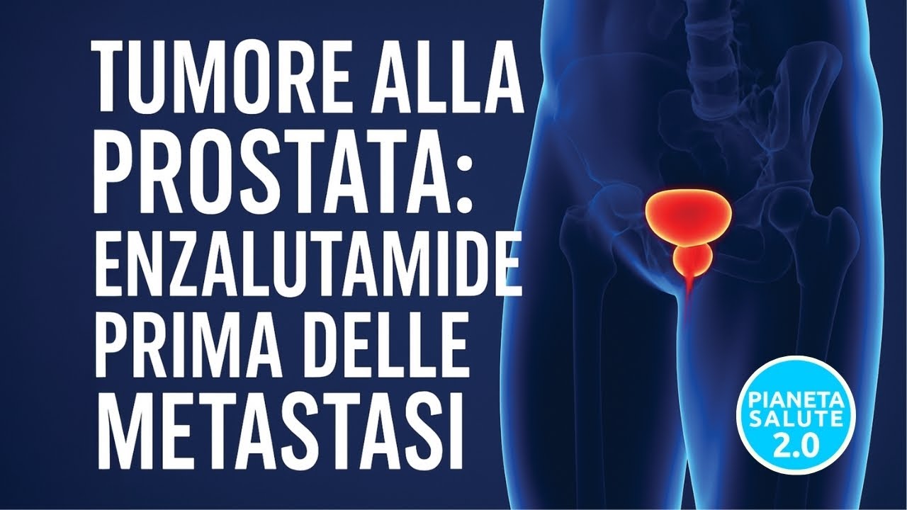 Tumore alla prostata: AIFA approva Enzalutamide anche prima delle metastasi