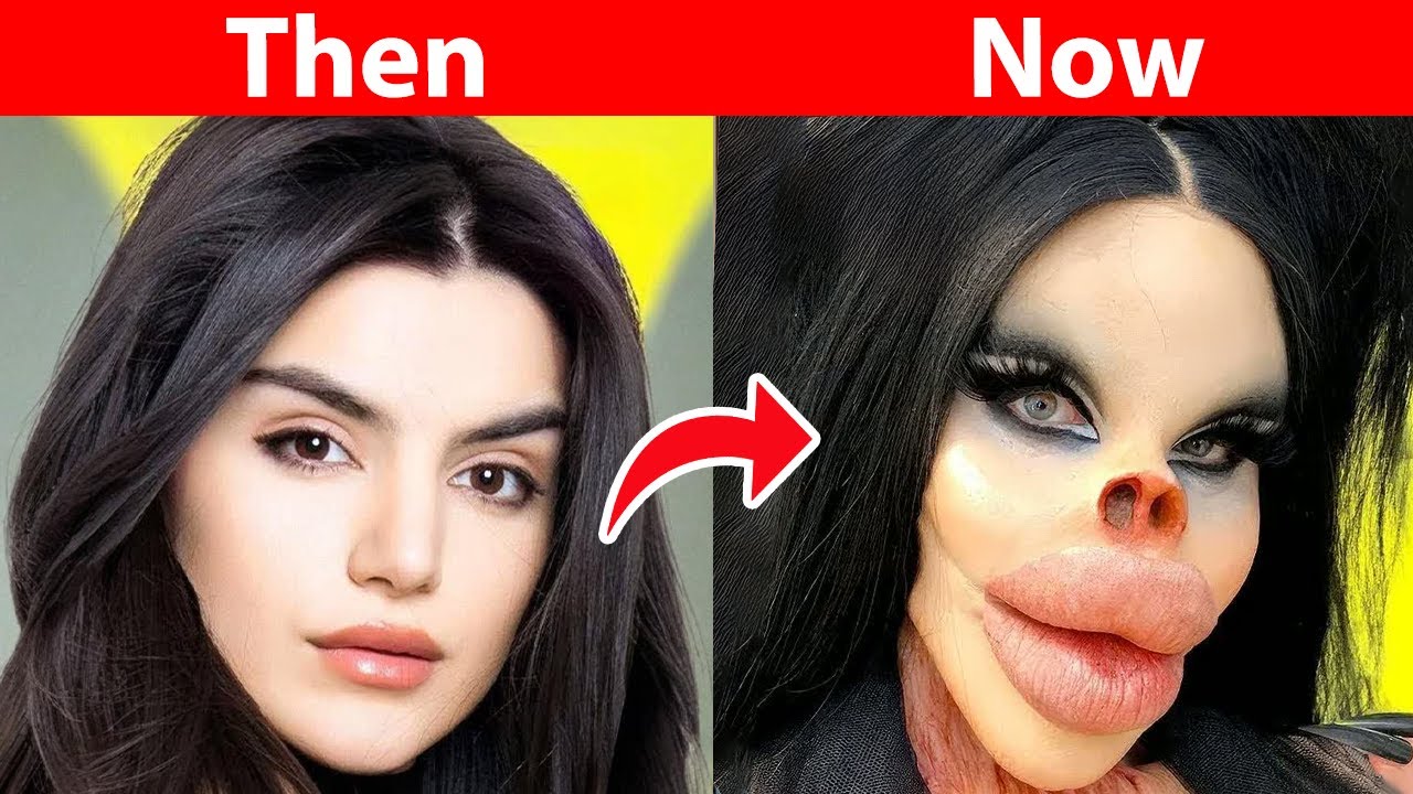 Disaster for These Stars After Plastic Surgery!