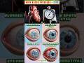 Your Eyes May Reveal High or Low Blood Pressure ⚠️