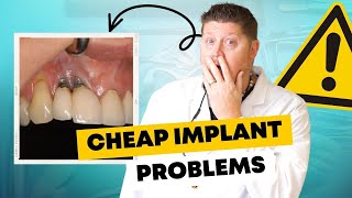 These are the BIGGEST Problems with Cheap Dental Implants