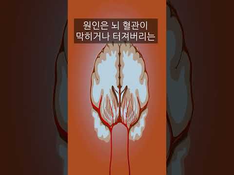 죽을 사람을 살리는 방법