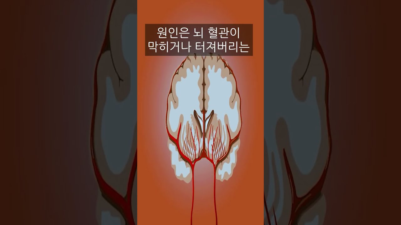 죽을 사람을 살리는 방법