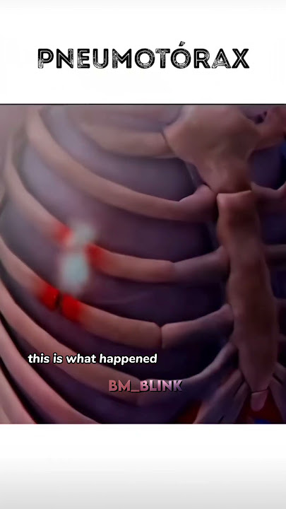 update on Rami π?#shorts #rami #babymonster #viralvideo #fypviralγ·